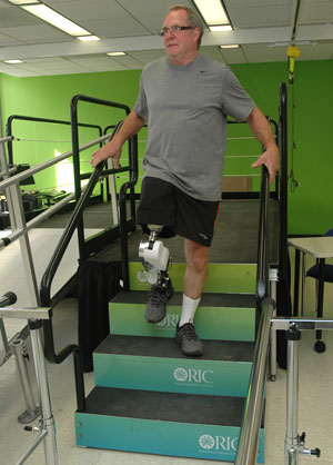 emg-powered-prosthetic-legs