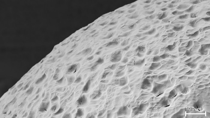 پژوهشگران ماده‌ای به نام آلژینات را که در این تصویر میکروسکوپ الکترونی مشاهده می‌شود برای محافظت از سلول‌های تولید کنندۀ انسولین در برابر سامانه ایمنی بدن بکار گرفتند.