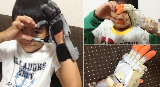 دست مصنوعی چاپ سه‌بعدی برای کودک ژاپنی