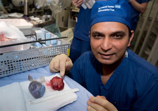 مدل جراحی سه‌بعدی برای کمک به برداشتن تومور پروستات