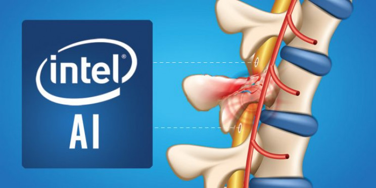 آغاز پژوهش اینتل و دانشگاه براون برای ایجاد یک سامانه هوش مصنوعی و کمک به بیماران آسیب نخاعی