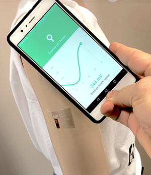 Grapheal پچ پوستی ردیاب زخم