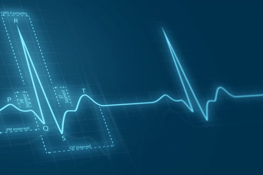 افت قند خون و دادههای ECG