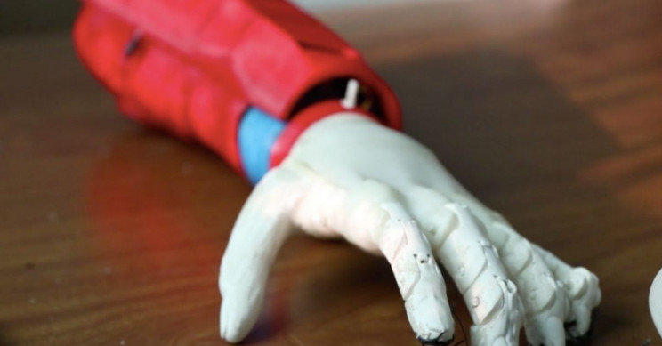 پروتز بیونیک Cure Bionics