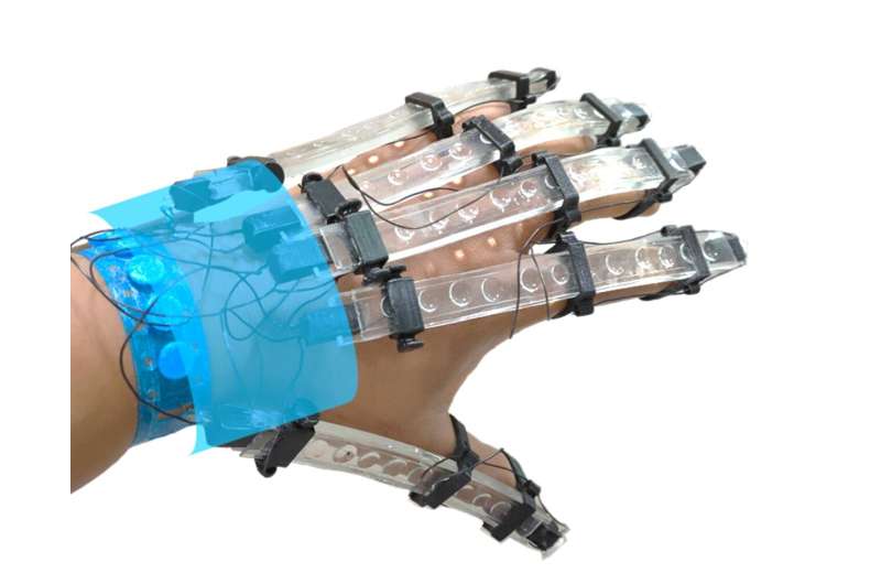 دستکش های چاپ سه بعدی برای توانبخشی بیماران سکته مغزی